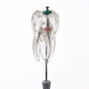 Endodoncia